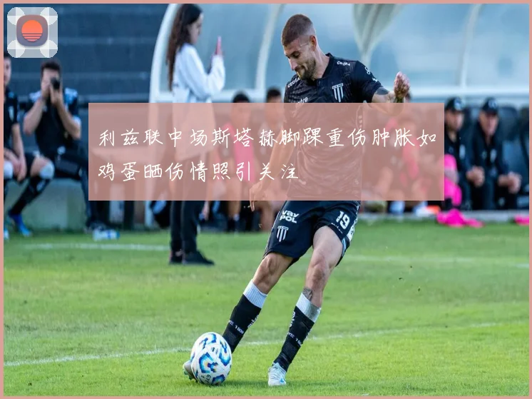 利兹联中场斯塔赫脚踝重伤肿胀如鸡蛋晒伤情照引关注